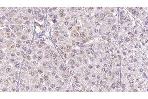 Immunohistochemistry (IHC) image for anti-serpin Peptidase Inhibitor, Clade F (Alpha-2 Antiplasmin, Pigment Epithelium Derived Factor), Member 1 (SERPINF1) (C-Term) antibody (ABIN6265012)