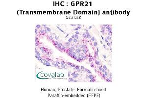 Image no. 1 for anti-G Protein-Coupled Receptor 21 (GPR21) antibody (ABIN1735029) (GPR21 Antikörper)