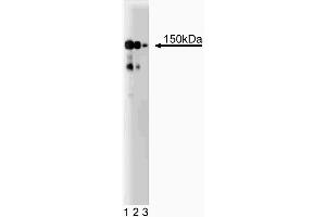 Western blot analysis of CD49b (Integrin alpha2) on a HeLa cell lysate (Human cervical epitheloid carcinoma, ATCC CCL-2. (ITGA2 Antikörper  (AA 42-245))