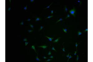 Immunofluorescence staining of U251 cells with ABIN7145025-IF at 1:100, counter-stained with DAPI.