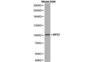 Western Blotting (WB) image for anti-Wolfram Syndrome 1 (WFS1) antibody (ABIN1875347)