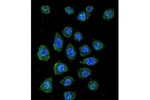 Confocal immunofluorescent analysis of BPN1L Antibody (Center) (ABIN655857 and ABIN2845264) with A549 cell followed by Alexa Fluor 488-conjugated goat anti-rabbit lgG (green). (PABPN1L Antikörper  (AA 166-194))