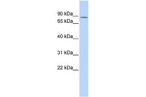 WB Suggested Anti-ZNF667 Antibody Titration:  0. (ZNF667 Antikörper  (Middle Region))