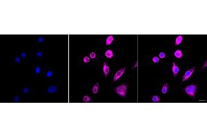 anti-Paraoxonase 2 (PON2) antibody