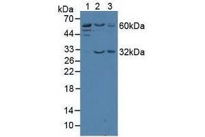 Western blot analysis of (1) Human Jurkat Cells, (2) Human HeLa cells and (3) Human K562 Cells. (TRF2 Antikörper  (AA 144-438))