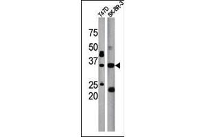 ICMT Antikörper  (C-Term)