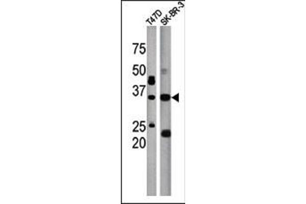 ICMT Antikörper  (C-Term)