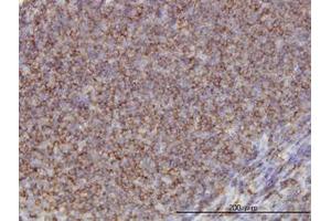 Image no. 1 for anti-Adducin 1 (Alpha) (ADD1) (AA 1-663) antibody (ABIN598527) (alpha Adducin Antikörper  (AA 1-663))