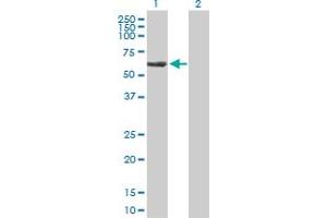 Western Blot analysis of TBCE expression in transfected 293T cell line by TBCE MaxPab polyclonal antibody. (TBCE Antikörper  (AA 1-527))