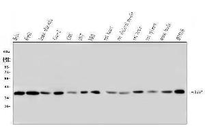 Western blot analysis of ARA9/AIP using anti-ARA9/AIP antibody (ABIN6719423).