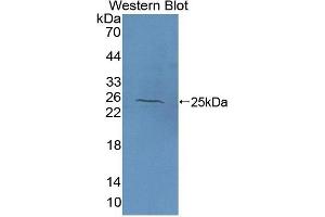 Detection of Recombinant NAGa, Human using Polyclonal Antibody to N-Acetylgalactosaminidase Alpha (NAGa) (NAGA Antikörper  (AA 18-217))