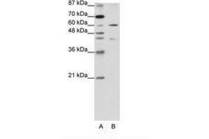 Image no. 1 for anti-Zinc Finger Protein 496 (ZNF496) (N-Term) antibody (ABIN202790) (ZNF496 Antikörper  (N-Term))