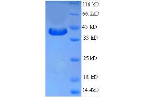 Interferon gamma (IFNG) (AA 24-162), (partial) protein (GST tag)