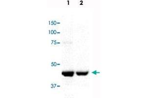 Western blot analysis in Lane 1: mitotic HeLa cell lysate and Lane 2: mitotic Jurkat cell lysate with CENPE monoclonal antibody, clone CENP-E. (CENPE Antikörper)