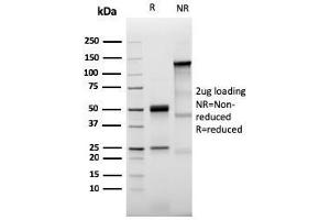 SDS-PAGE Analysis Purified Prolactin Receptor Recombinant Rabbit Monoclonal (PRLR3785R).