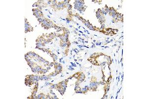 Immunohistochemistry (IHC) image for anti-Thiosulfate Sulfurtransferase (Rhodanese) (TST) (AA 1-297) antibody (ABIN6149660)