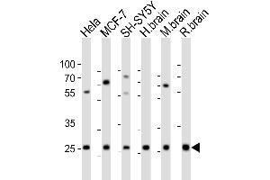 Western blot analysis of lysates from Hela, MCF-7, SH-SY5Y cell line, human brain, mouse brain, rat brain tissue (from left to right), using NTF3 Antibody (Center) (ABIN6242464 and ABIN6577625). (Neurotrophin 3 Antikörper  (AA 89-120))