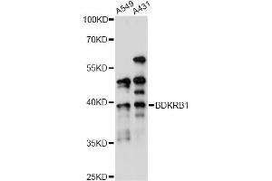 Western blot analysis of extracts of various cell lines, using BDKRB1 antibody (ABIN6290094) at 1:1000 dilution. (BDKRB1 Antikörper)