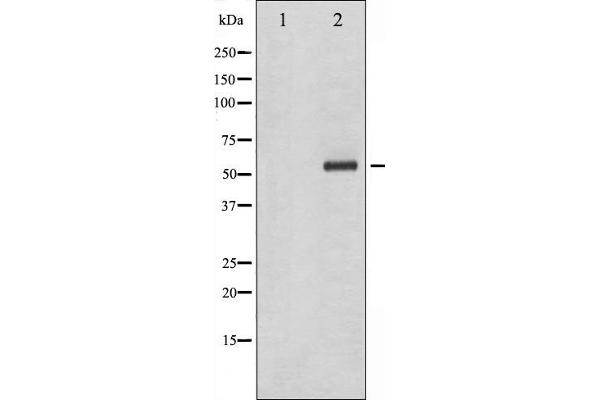 CHEK1 Antikörper  (pSer286)
