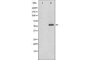 Western blot analysis of Chk1 phosphorylation expression in Na3VO4 treated K562 whole cell lysates,The lane on the left is treated with the antigen-specific peptide.