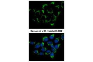 ICC/IF Image Immunofluorescence analysis of methanol-fixed A431, using CMG1, antibody at 1:500 dilution.