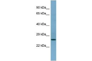 WB Suggested Anti-APIP  Antibody Titration: 0. (APIP Antikörper  (Middle Region))
