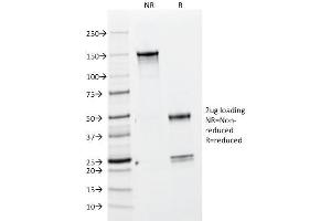 SDS-PAGE Analysis Purified BrdU Mouse Monoclonal Antibody (BRD469). (BrdU Antikörper)
