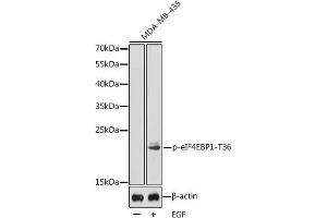 Western blot analysis of extracts from MDA-MB-435 cells, using Phospho-eIF4EBP1-T36 antibody (ABIN3020195, ABIN3020196, ABIN3020197 and ABIN1681563). (eIF4EBP1 Antikörper  (pThr36))