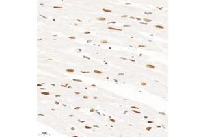 Immunohistochemistry analysis of paraffin-embedded rat heart using HNRNPM (ABIN7074247) at dilution of 1: 4000 (HnRNP M1-M4 Antikörper)