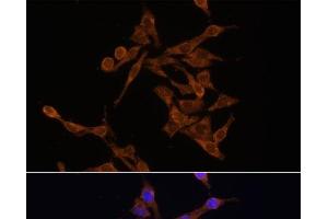 Immunofluorescence analysis of HeLa cells using UBE2J1 Polyclonal Antibody at dilution of 1:100. (UBE2J1 Antikörper)