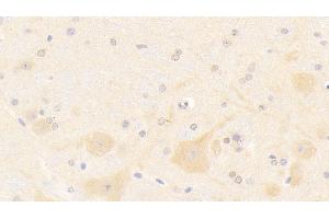 Detection of NOS1 in Mouse Cerebellum Tissue using Polyclonal Antibody to Nitric Oxide Synthase 1, Neuronal (NOS1) (NOS1 Antikörper  (AA 691-826))