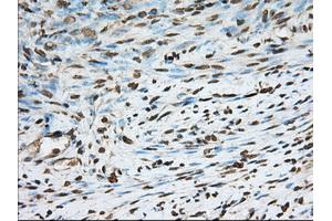 Immunohistochemical staining of paraffin-embedded Human Kidney tissue using anti-PDE4A mouse monoclonal antibody. (PDE4A Antikörper)