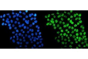 IF analysis of HDAC5 using anti-HDAC5 antibody (ABIN7599922). (HDAC5 Antikörper  (AA 13-1107))