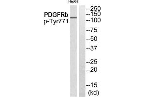 Western Blotting (WB) image for anti-Epidermal Growth Factor Receptor Pathway Substrate 15 (EPS15) (pTyr849) antibody (ABIN1847772) (EPS15 Antikörper  (pTyr849))