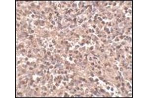 Immunohistochemistry: ATG5 antibody staining of Rat Spleen tissue lysate at 2 μg/ml (ATG5 Antikörper  (N-Term))