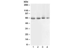 Western blot testing of 1) rat muscle, 2) human COLO320, 3) human 22RV1 and 4) human PANC lysate with ABCB10 antibody at 0. (ABCB10 Antikörper  (AA 640-678))