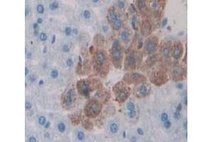 Used in DAB staining on fromalin fixed paraffin- embedded Kidney tissue (APBA3 Antikörper  (AA 261-506))