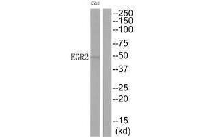 Western blot analysis of extracts from K562 cells, using EGR2 antibody. (EGR2 Antikörper  (C-Term))