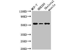 Western Blot Positive WB detected in: MCF-7 whole cell lysate, HEK293 whole cell lysate, Mouse skeletal muscle tissue All lanes: RMND1 antibody at 3 μg/mL Secondary Goat polyclonal to rabbit IgG at 1/50000 dilution Predicted band size: 52, 28, 24 kDa Observed band size: 52 kDa (RMND1 Antikörper  (AA 35-160))