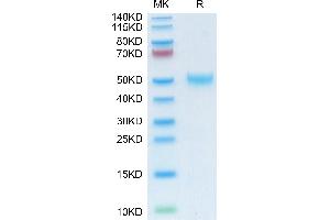 Mouse LRG1 on Tris-Bis PAGE under reduced condition. (LRG1 Protein (AA 33-342) (His tag))