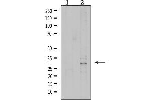 Western blot analysis of extracts from 293, using VTCN1 Antibody. (VTCN1 Antikörper  (Internal Region))