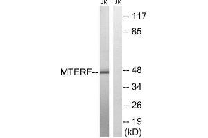 Western Blotting (WB) image for anti-Mitochondrial Transcription Termination Factor (MTERF) (Internal Region) antibody (ABIN1852304) (MTERF Antikörper  (Internal Region))