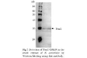 Western Blotting (WB) image for anti-CD248 Molecule, Endosialin (CD248) (full length) antibody (ABIN2452152) (CD248 Antikörper  (full length))