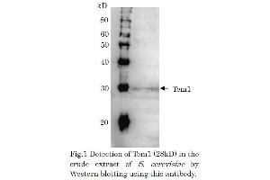 Western Blotting (WB) image for anti-CD248 Molecule, Endosialin (CD248) (full length) antibody (ABIN2452152)