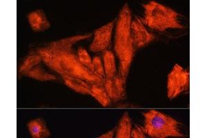 Immunofluorescence analysis of H9C2 cells using RIG-I / DDX58 Polyclonal Antibody at dilution of 1:100. (DDX58 Antikörper)