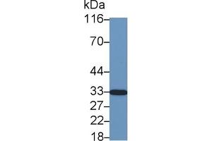 Detection of CDKN1B in Cavia Cerebrum lysate using Polyclonal Antibody to Cyclin Dependent Kinase Inhibitor 1B (CDKN1B)