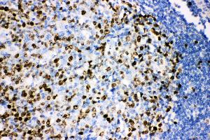 Anti-Ki67 Picoband antibody,  IHC(P): Human Tonsil Tissue (Ki-67 Antikörper  (AA 2860-3256))