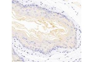 Immunohistochemistry analysis of paraffin-embedded mouse esophagus using,DSP (ABIN7073719) at dilution of 1: 1000