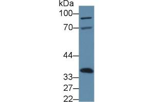 Western blot analysis of Mouse Liver lysate, using Mouse ANXA4 Antibody (3 µg/ml) and HRP-conjugated Goat Anti-Rabbit antibody ( (Annexin IV Antikörper  (AA 151-313))