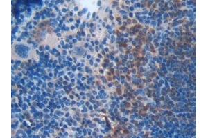 Immunohistochemistry (IHC) image for anti-BH3 Interacting Domain Death Agonist (BID) (AA 1-195) antibody (ABIN7432262)